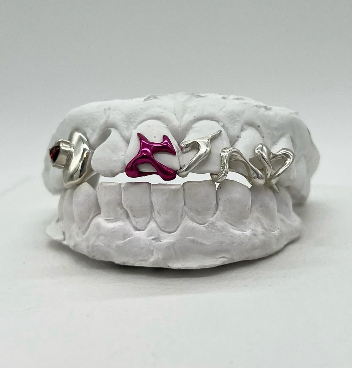Custom grillz (5 pieces)