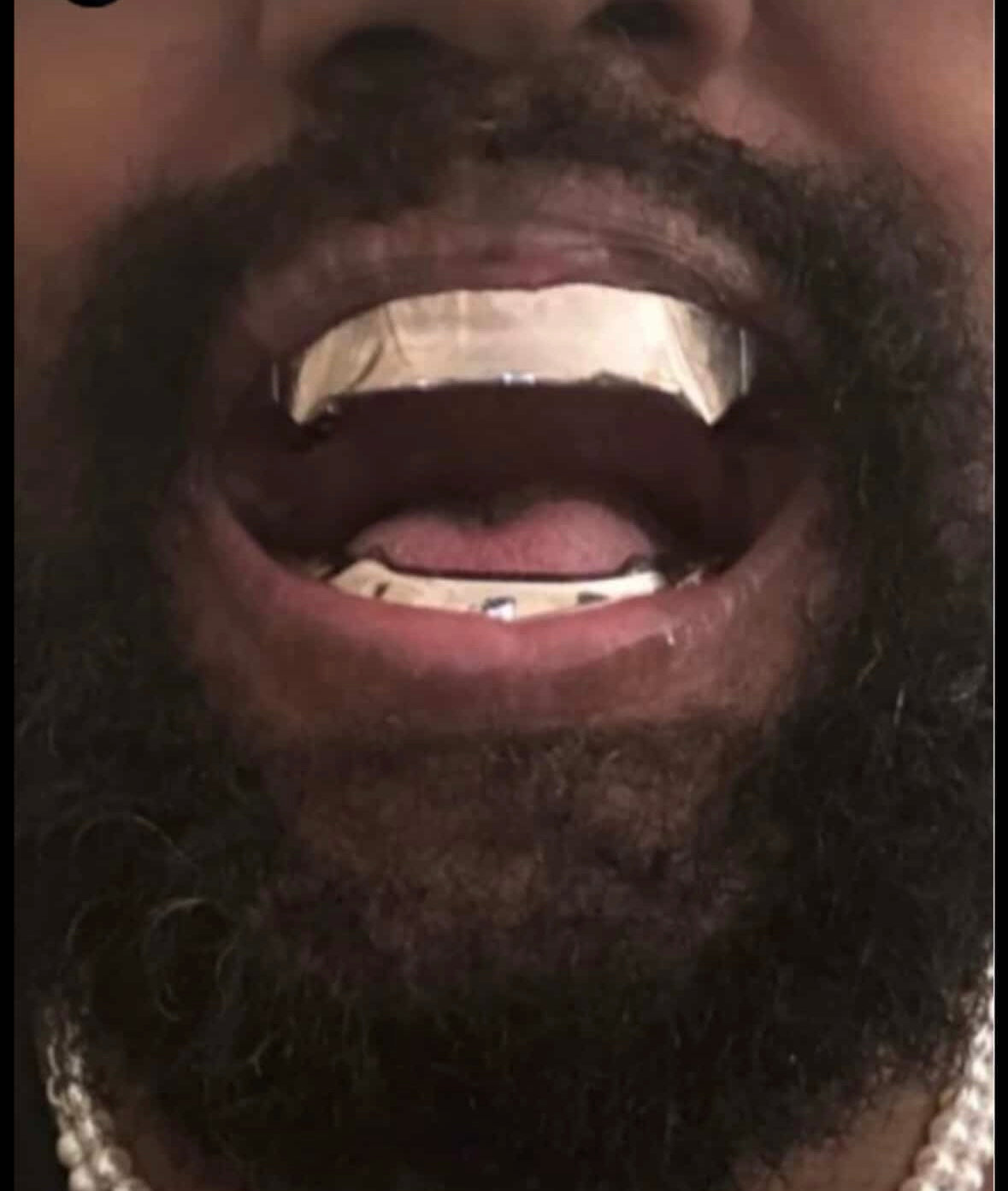 8cups+1cups