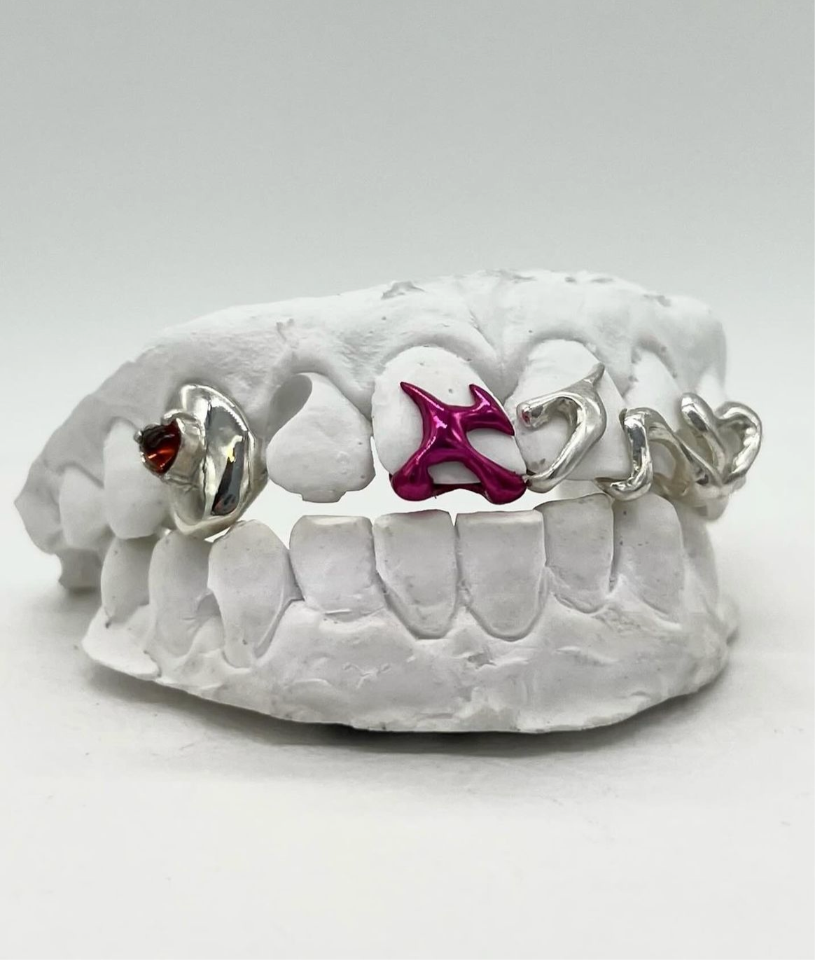 Custom grillz (5 pieces)